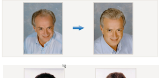 KTS Hair Replacement Systems Review KTS Hair Replacement Systems